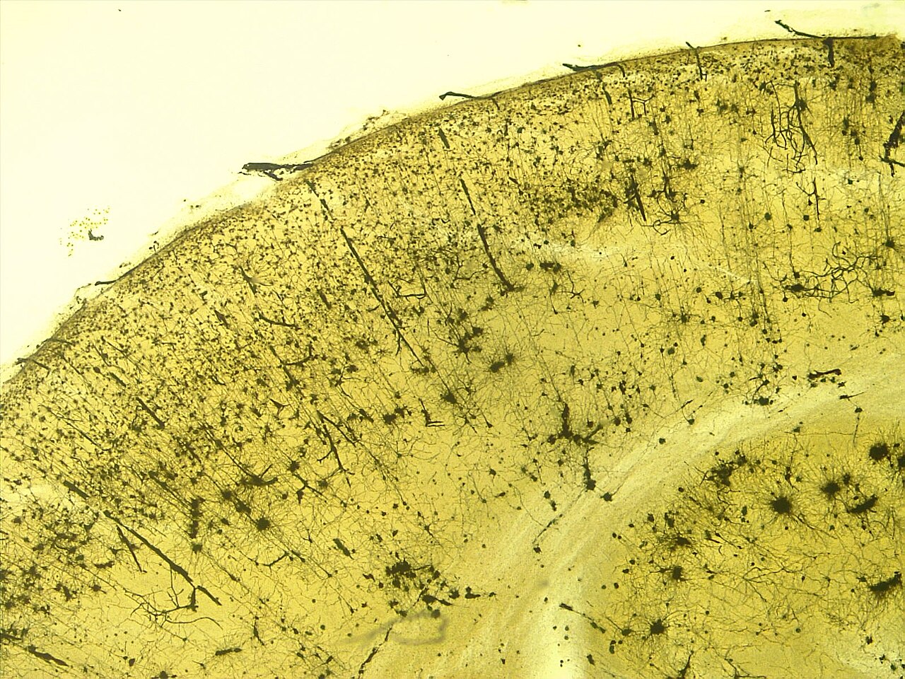 Cortical Neurons, stained.jpg